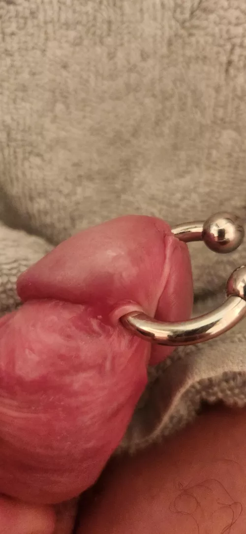 Does this look normal 