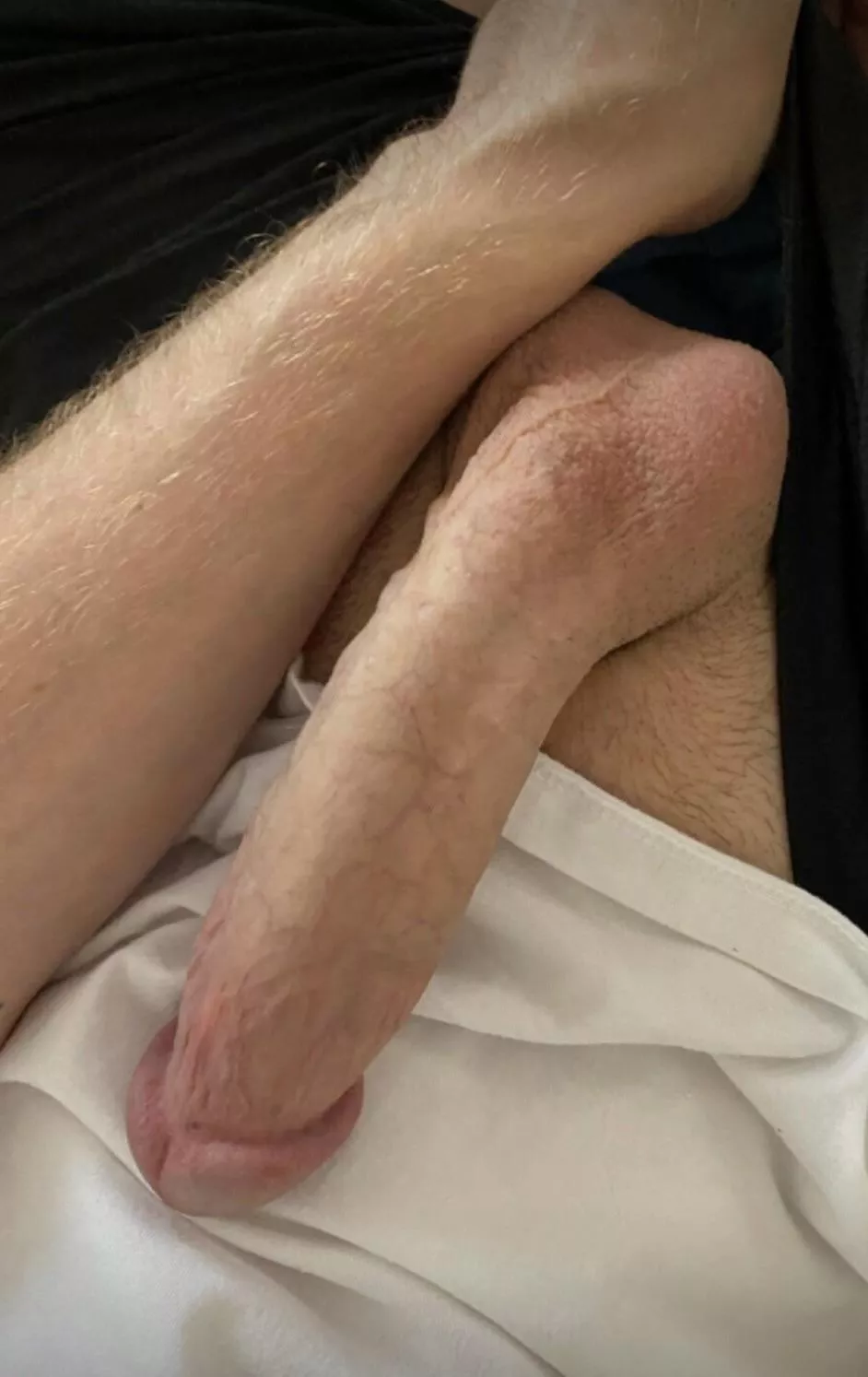 (m) 4 (w) 40 no strings 