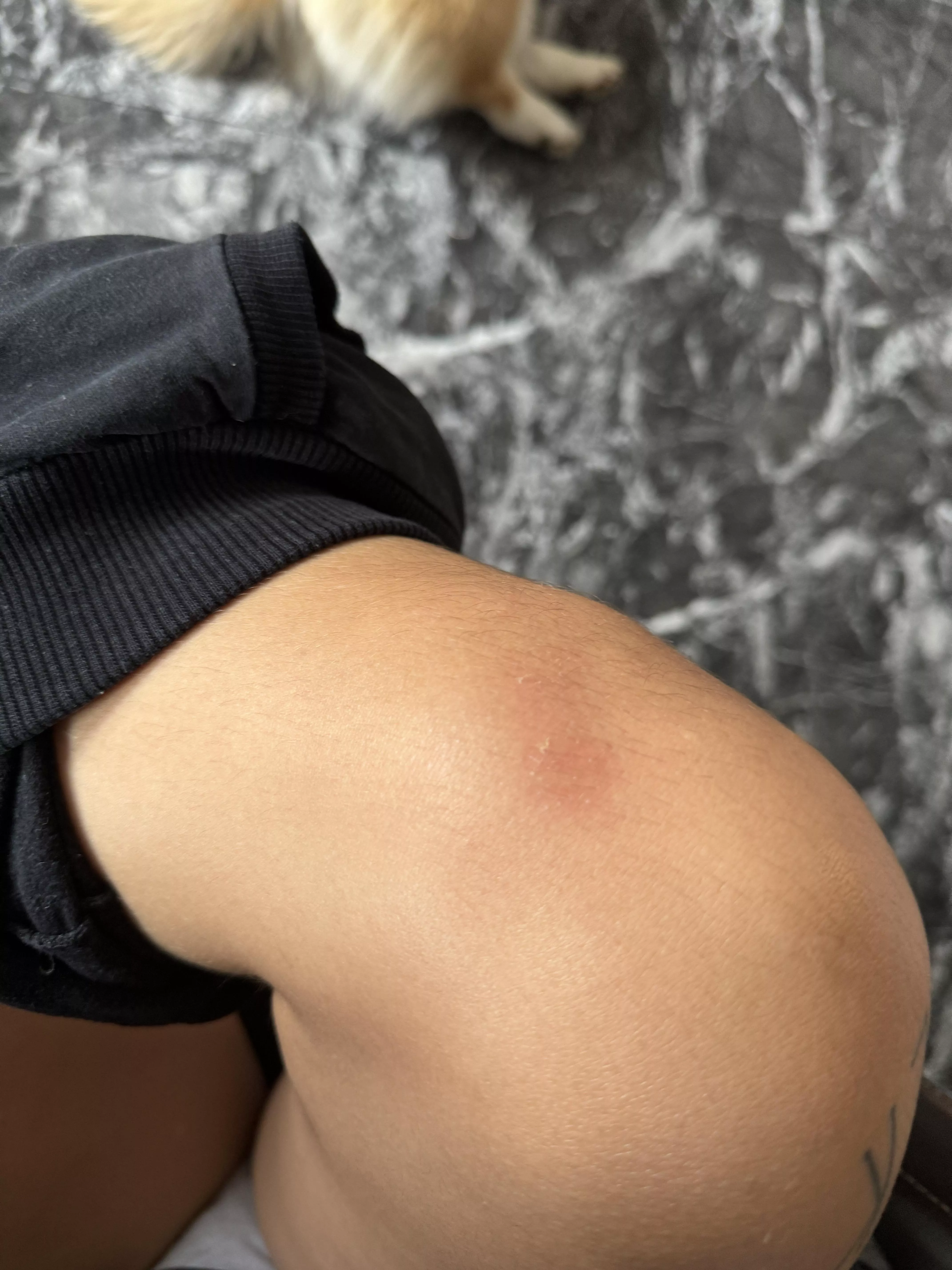 Some hairs have been lost, but they will grow back