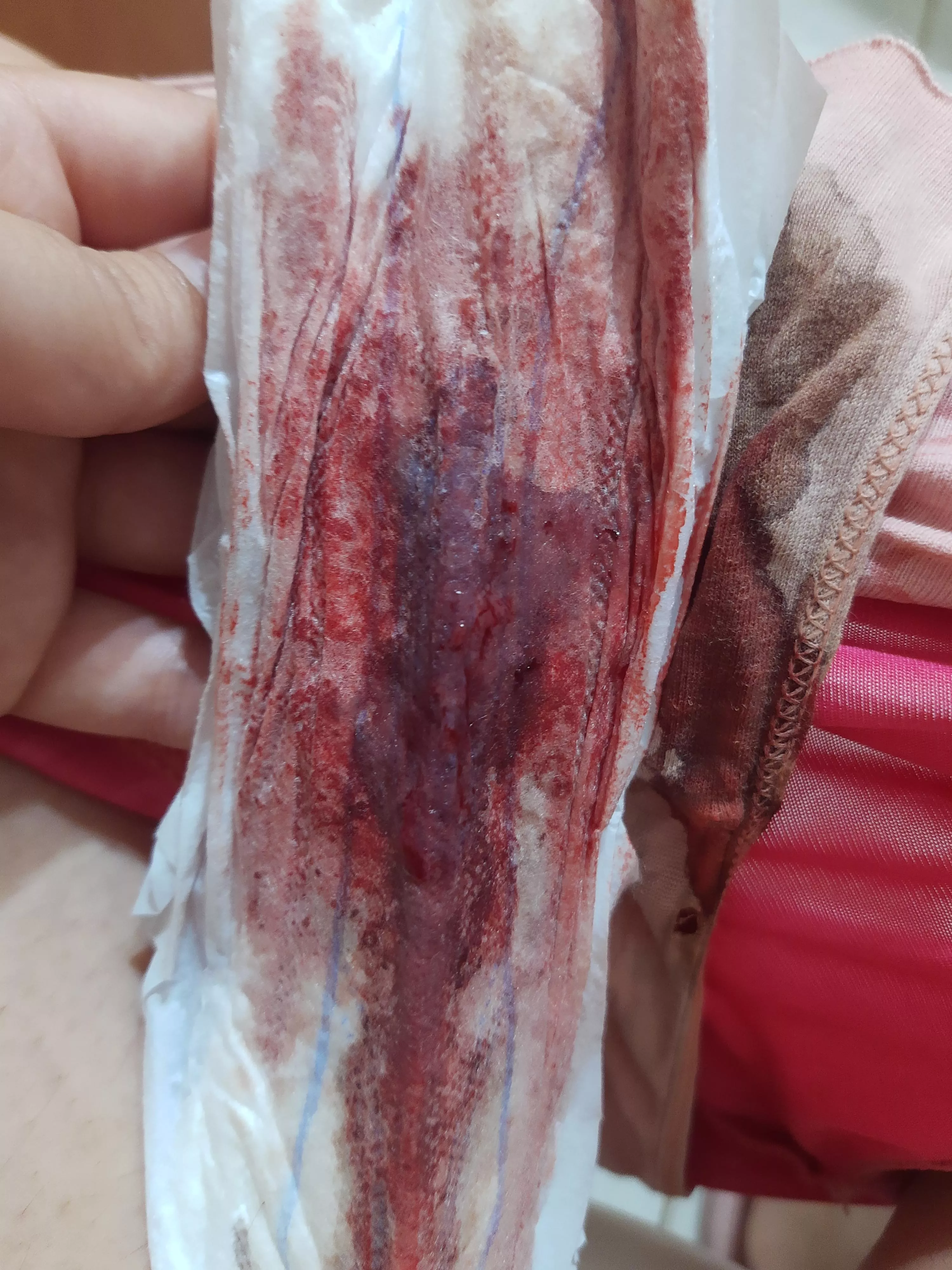 A bit of a hectic first day 🩸