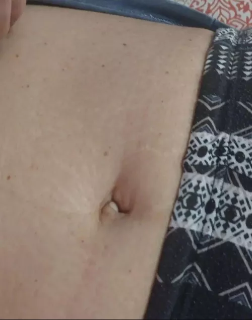 My inbetwinnie navel.(F)