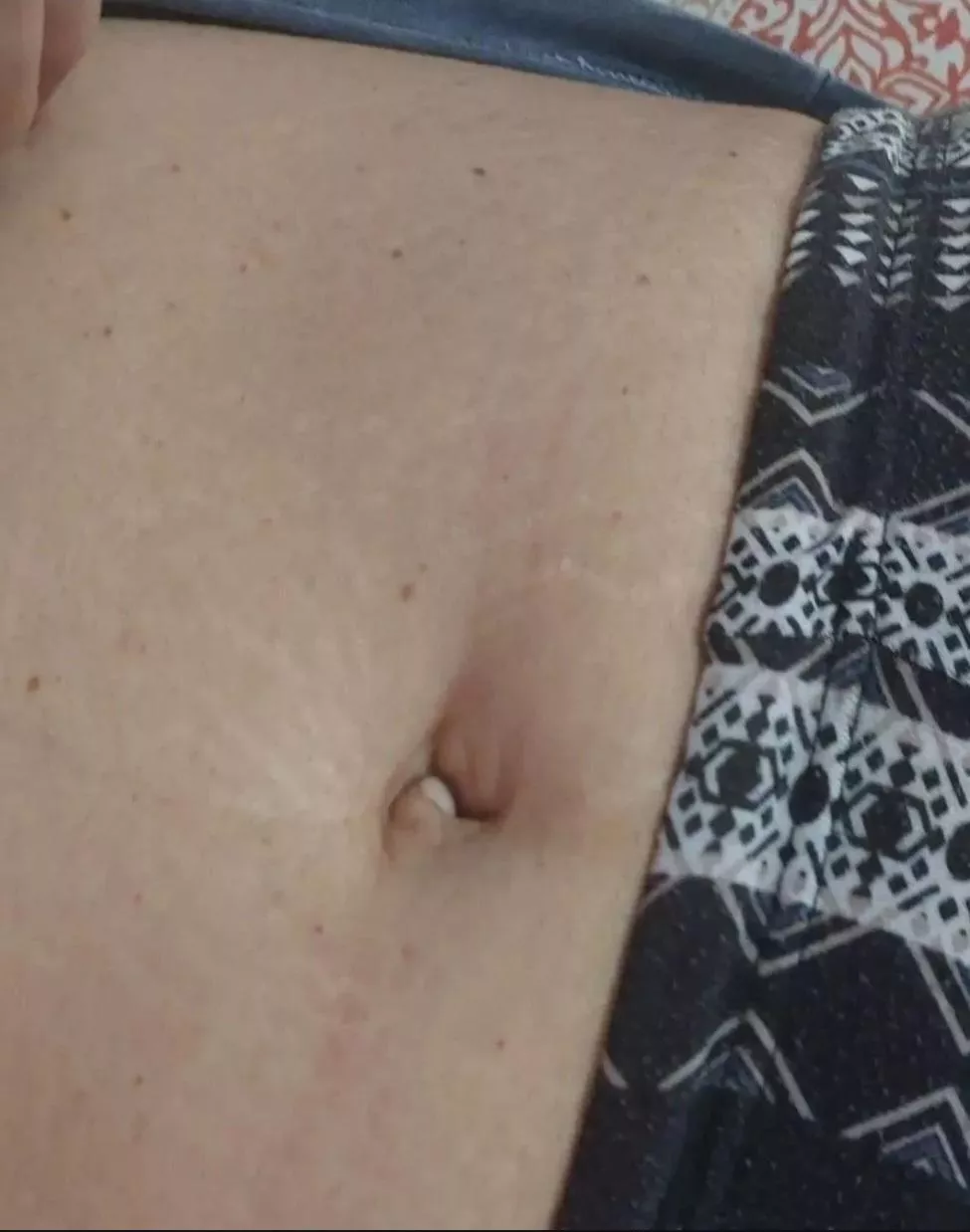 My inbetwinnie navel.(F)