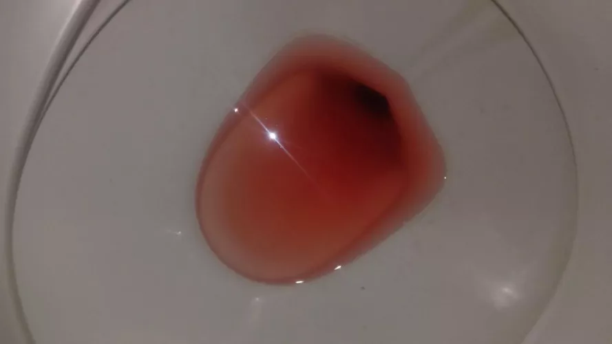 My period came hard today, don't you think? 🩸🩸