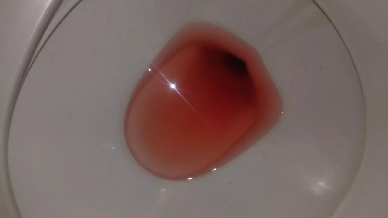 My period came hard today, don't you think? 🩸🩸