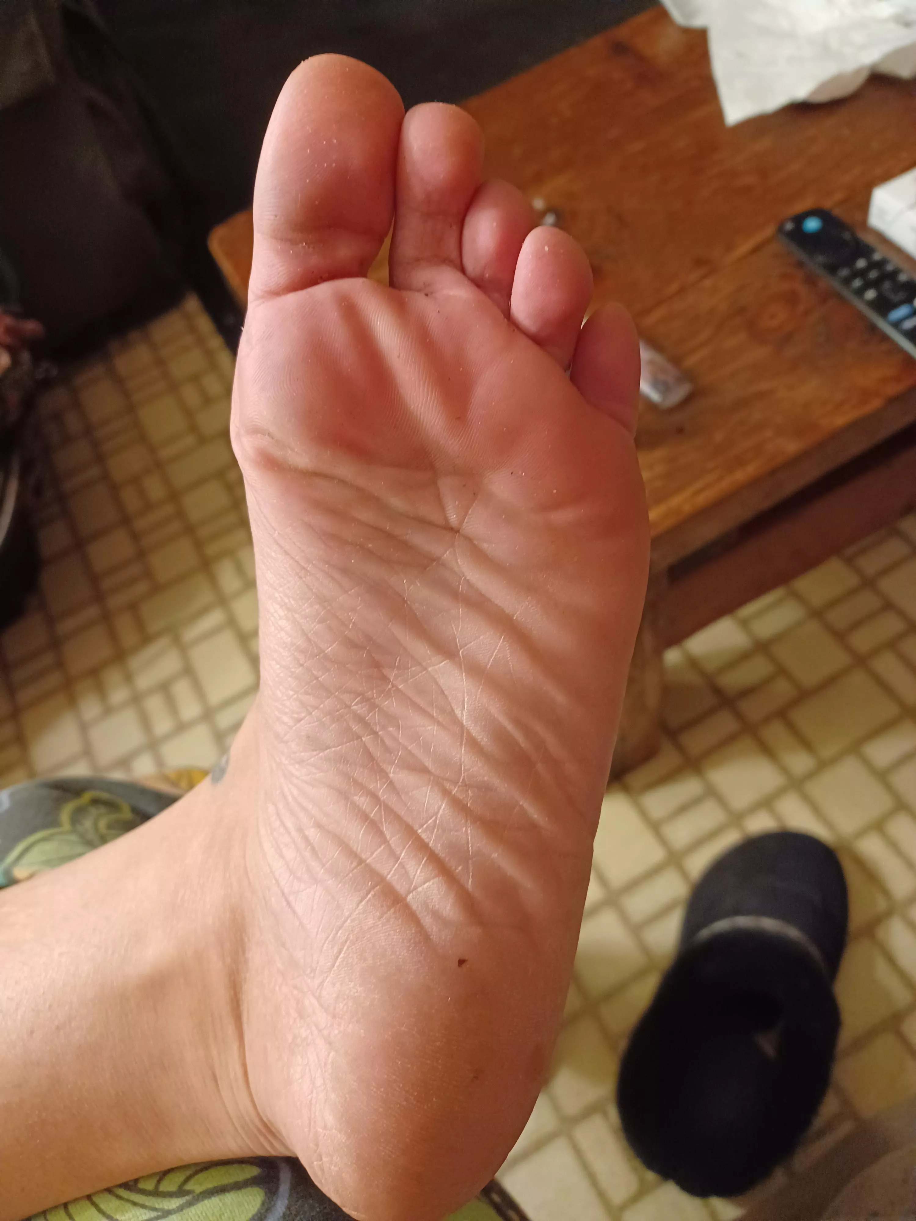 Smelly and wrinkly soles!!