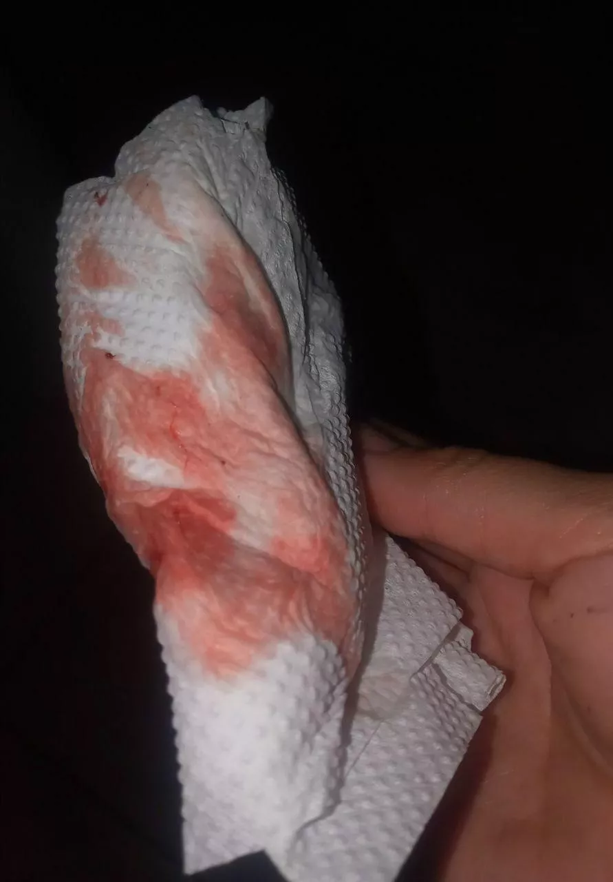 day 4, and it is a very strong current🩸🩸