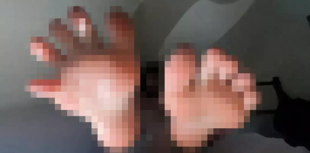 They are going to pop out your screen