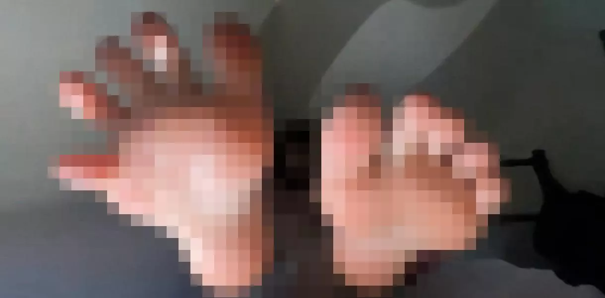 They are going to pop out your screen