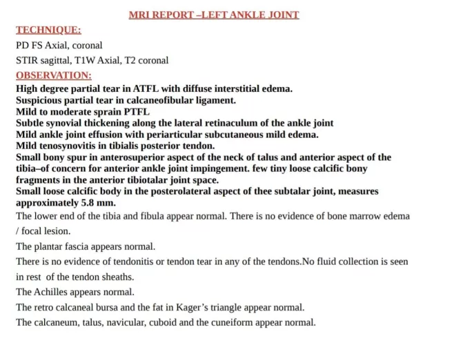 Ankle MRI Result Conclusion???