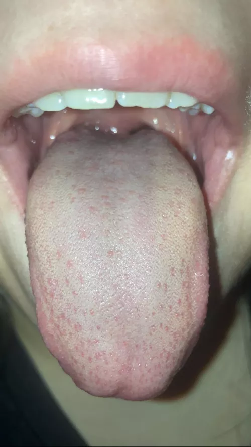 Daughter's Tongue, went to the Physician and was Ignored.