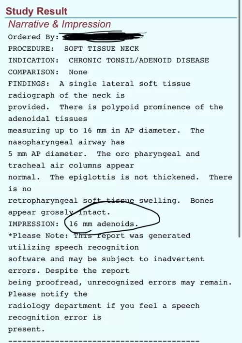ENT knowledge question………………..