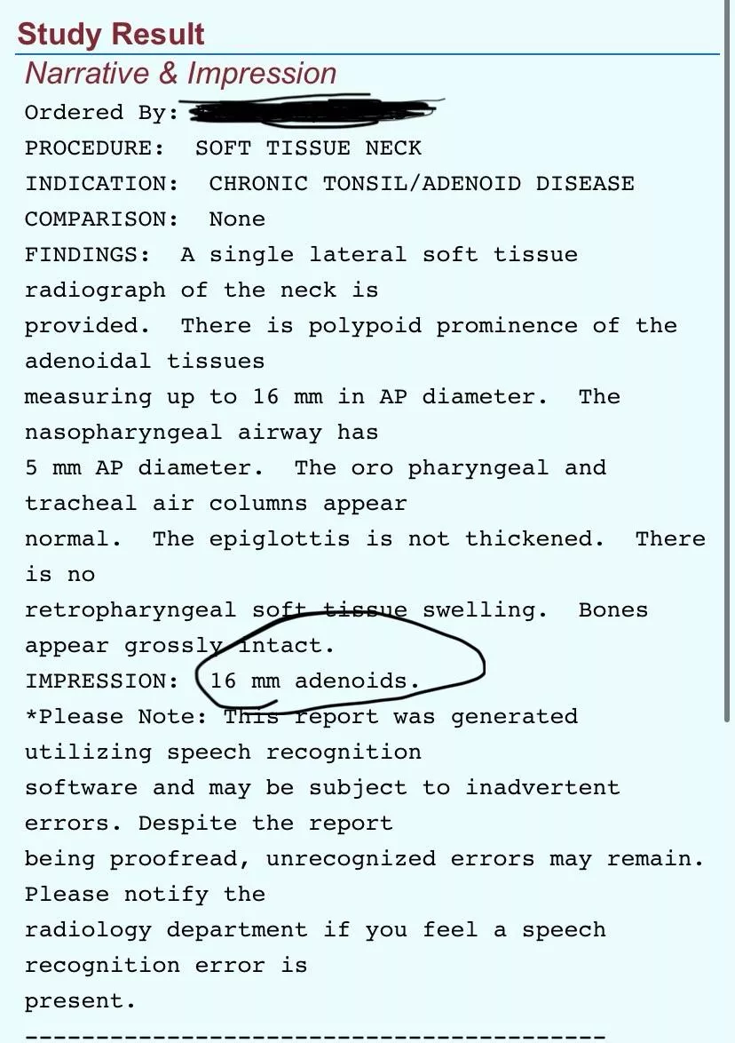 ENT knowledge question………………..