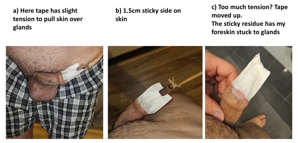 What thickness of T tape do you have attached on your skin?