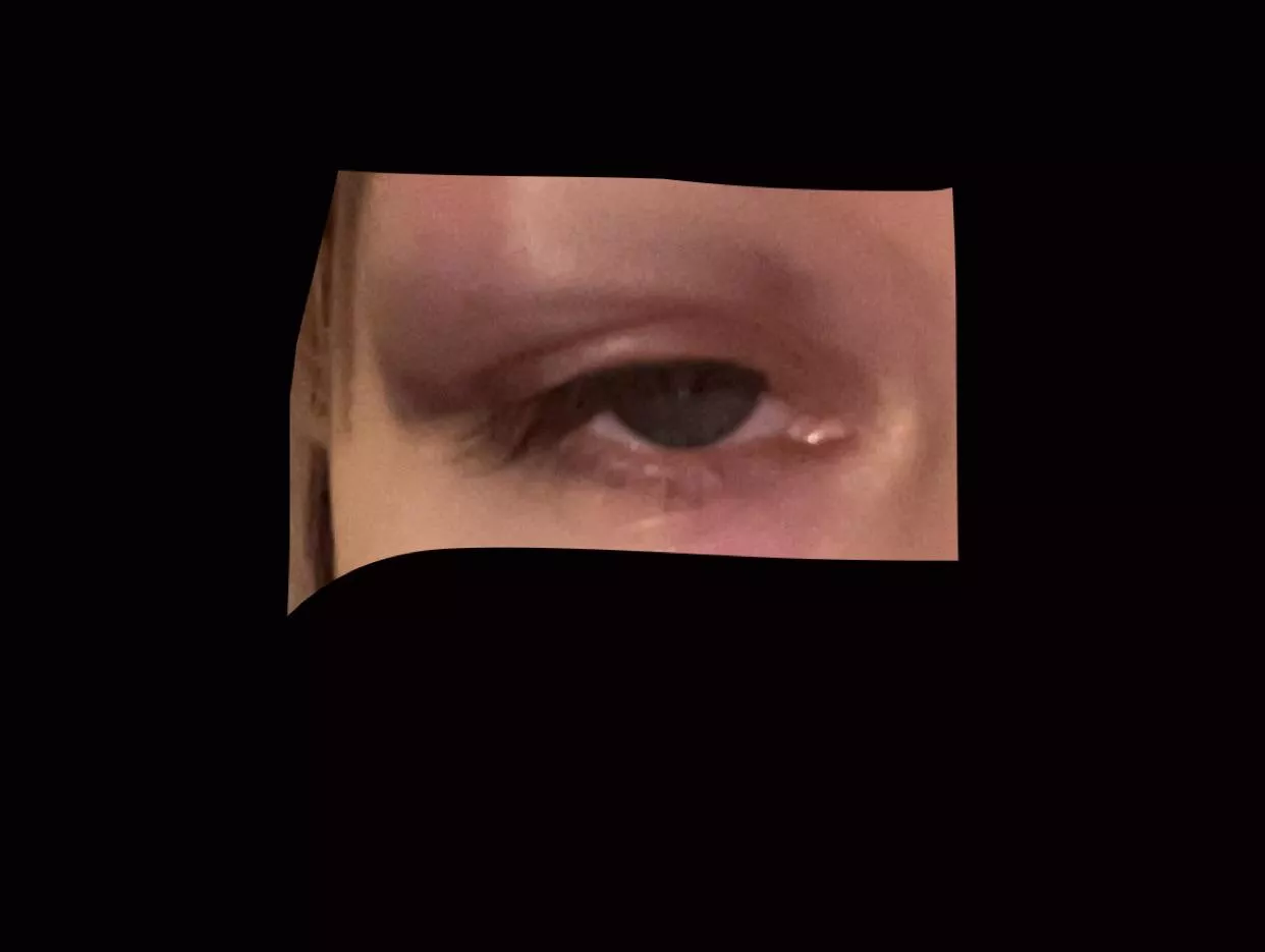 how long do you guys think it'll take for the swelling to go down?:,) busted my eye a few hours ago i've been applying ice 