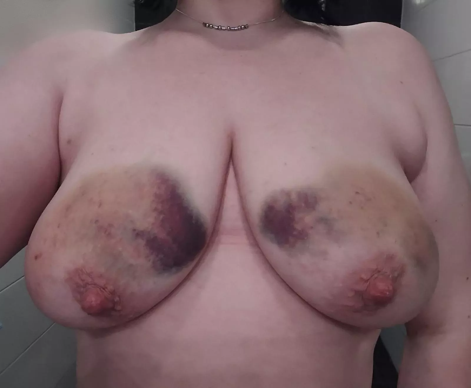 Only slight bruising from my reward spanking