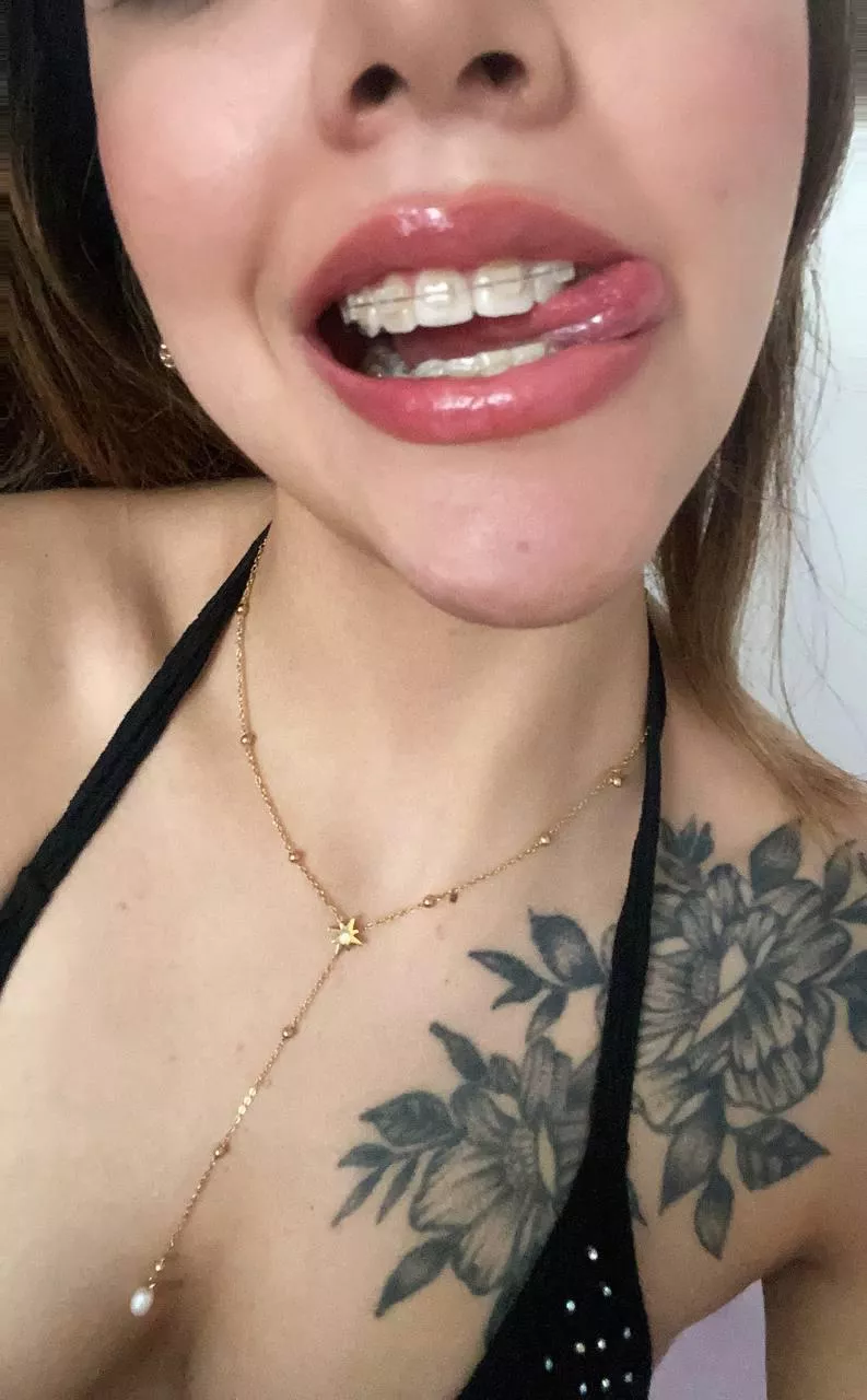 Can you make my braces all white and slimy