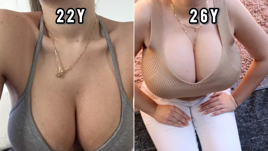 Do you like me better now or before? 