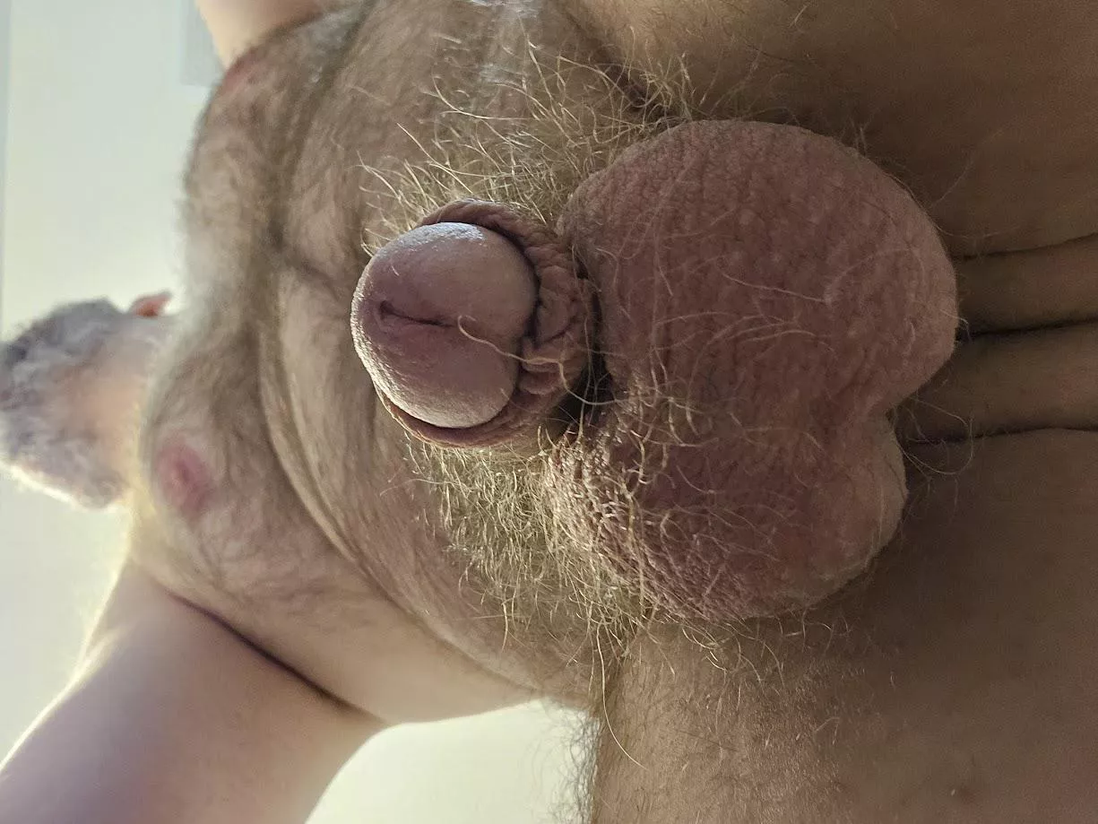 Is this your preferred POV?