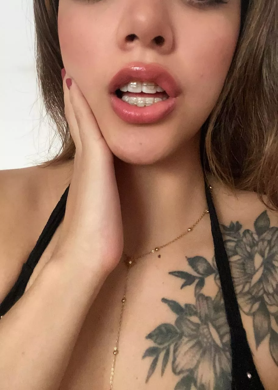 why do you guys love braces so muc, pls be honest 19F