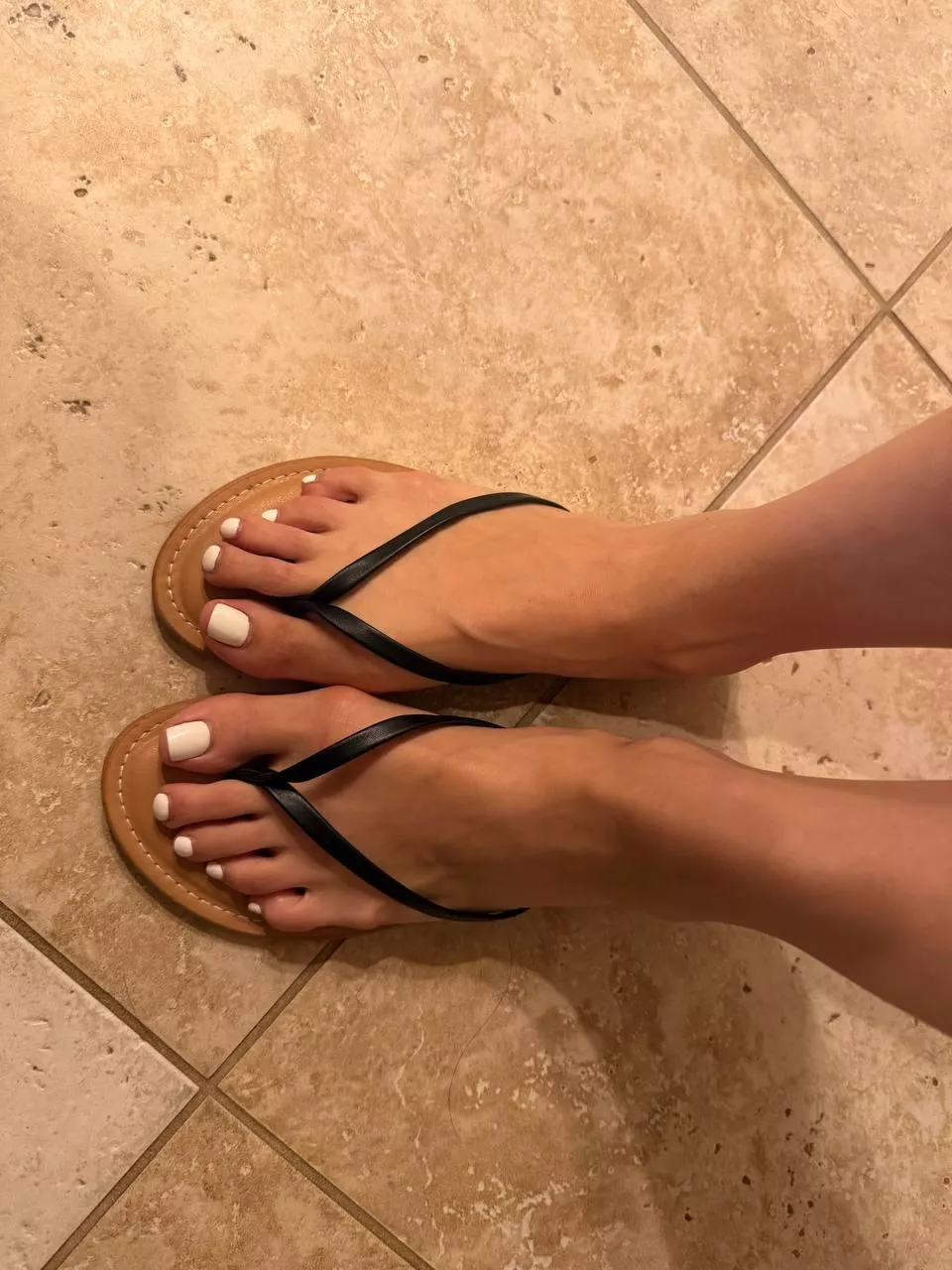 wife's feet after an 8-hour work shift