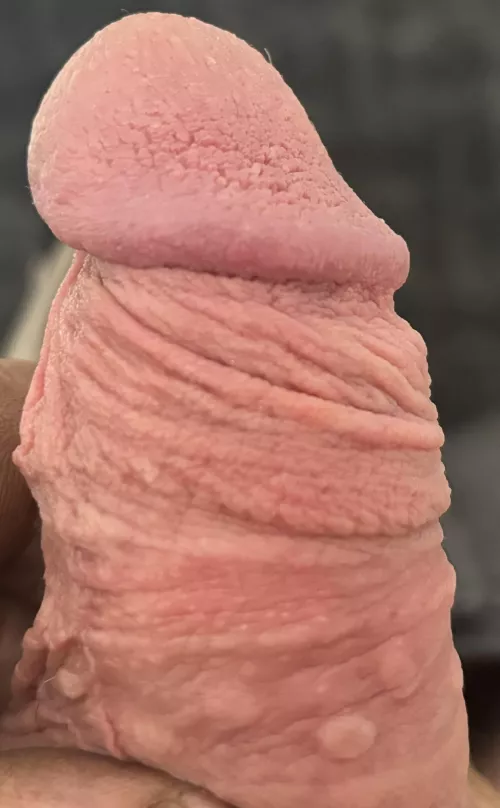 Frenulum remnant doing its job.