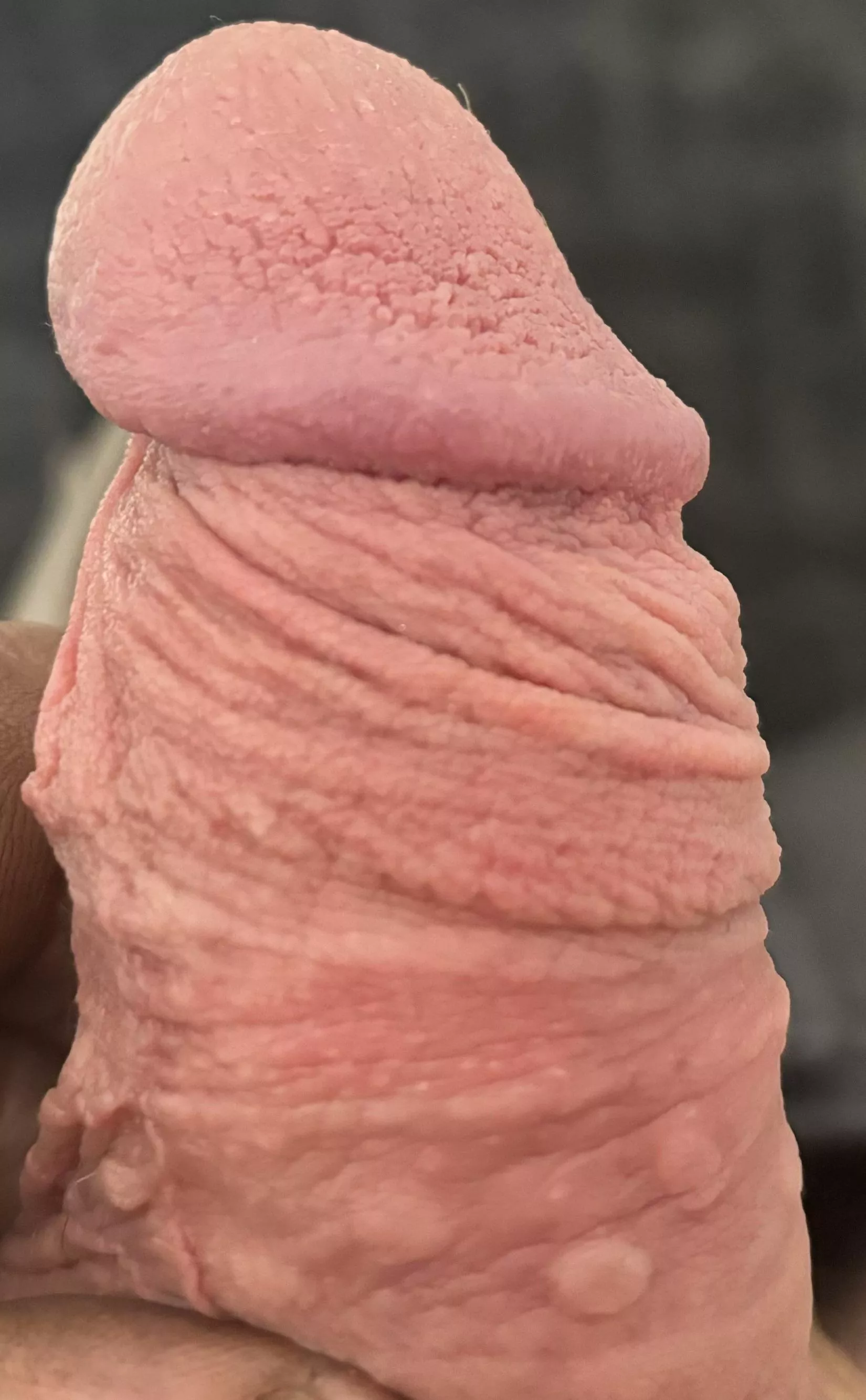 Frenulum remnant doing its job.