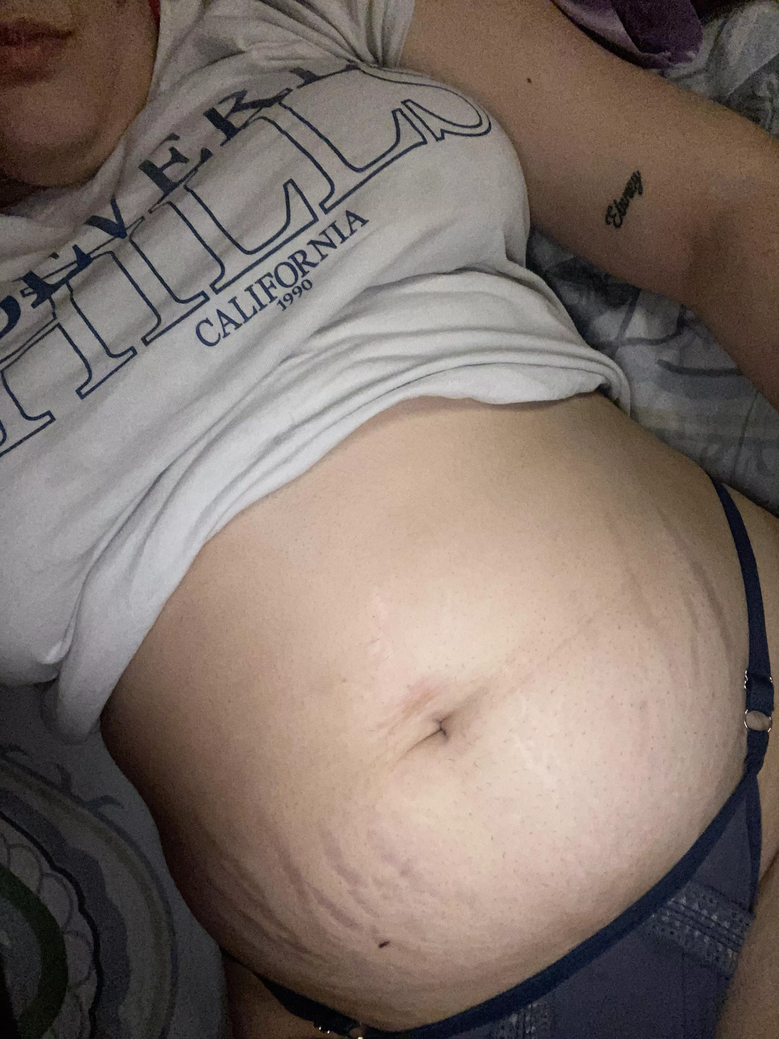 do you like my stretch marks? 