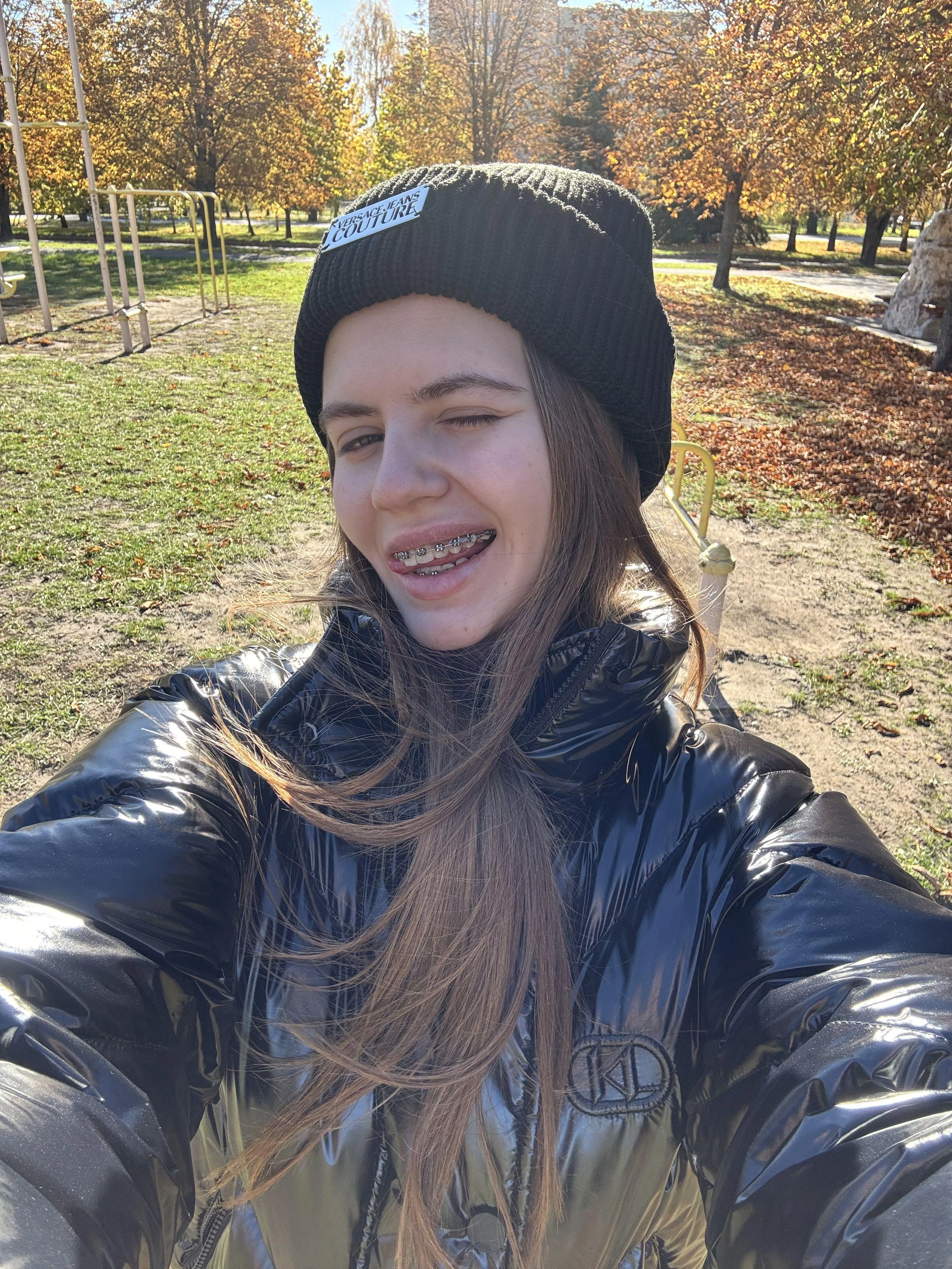 Sweet braces, sweet kisses