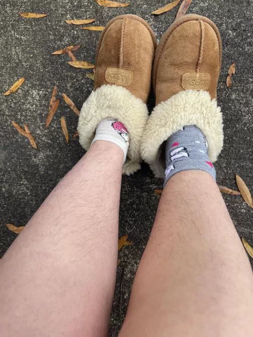 always most hairy on my calves