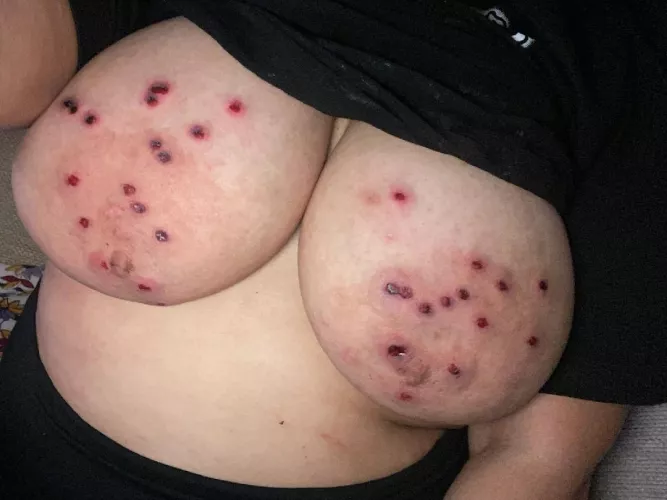 First step in debreasting her was target practice. 