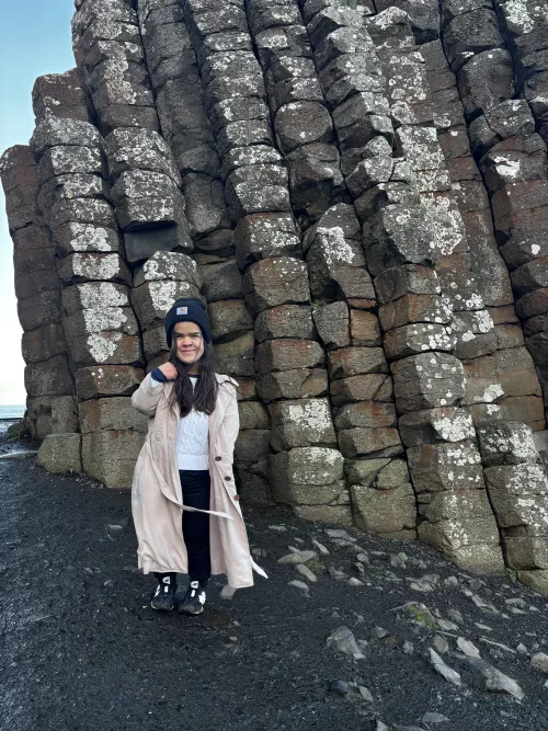 Have you seen the midgets causeway in Ireland?