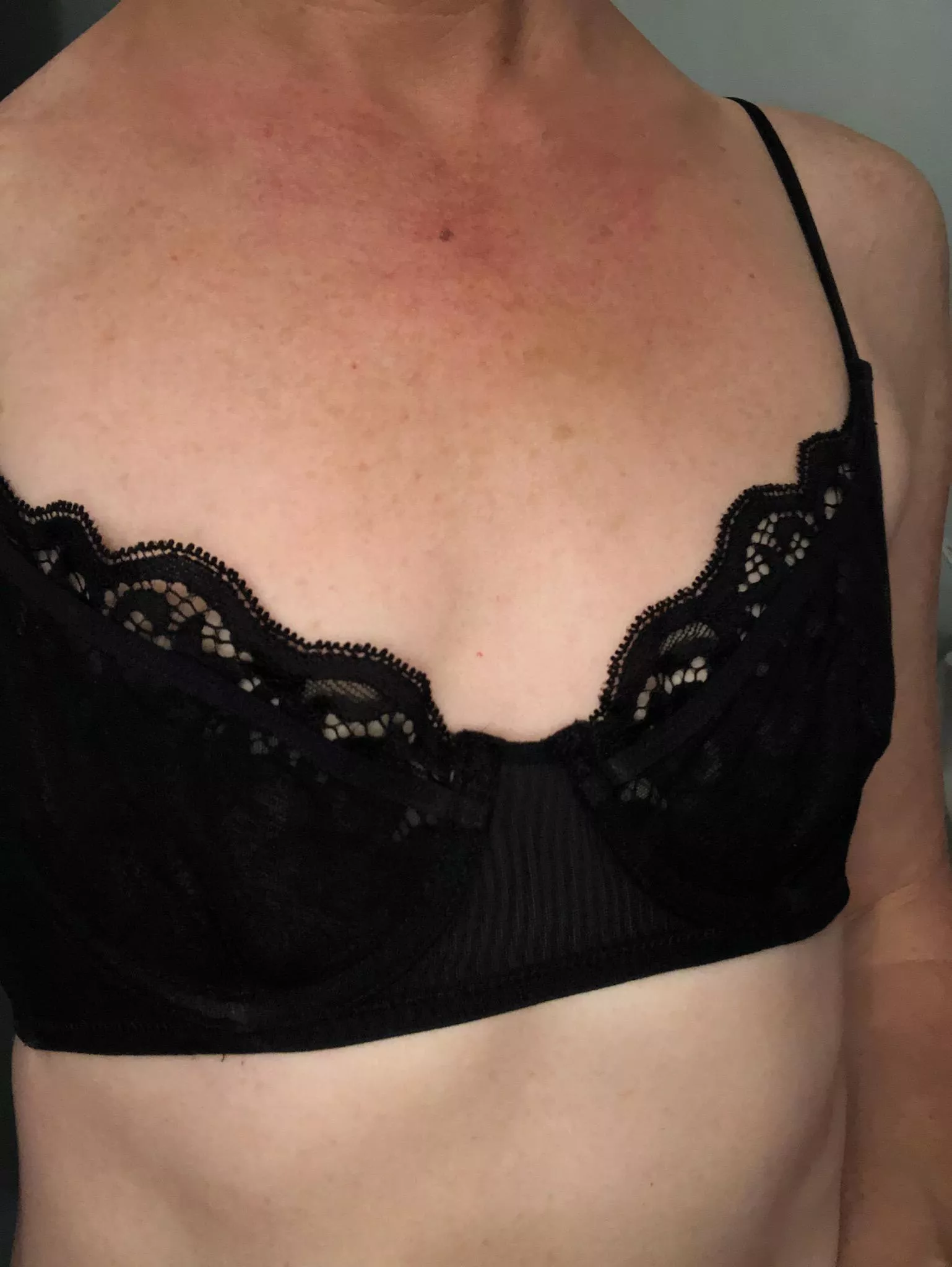 Hope you like my freckles 