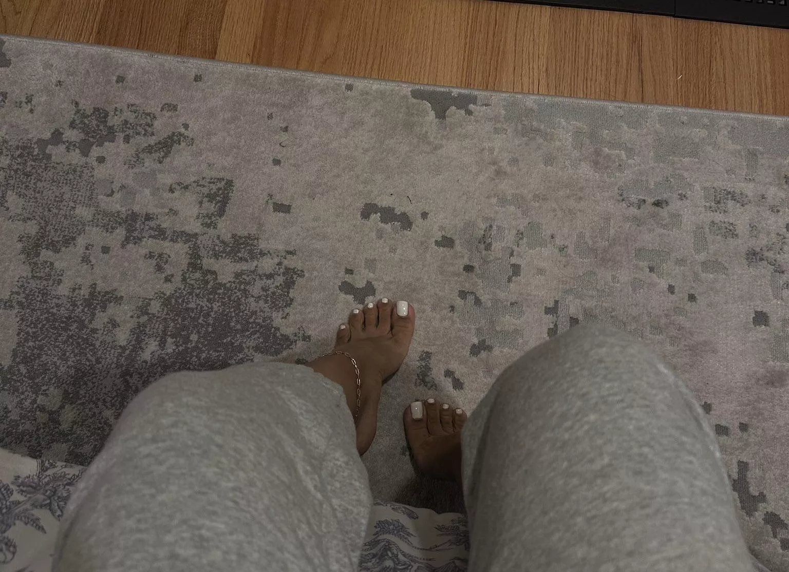 How do my feet look?