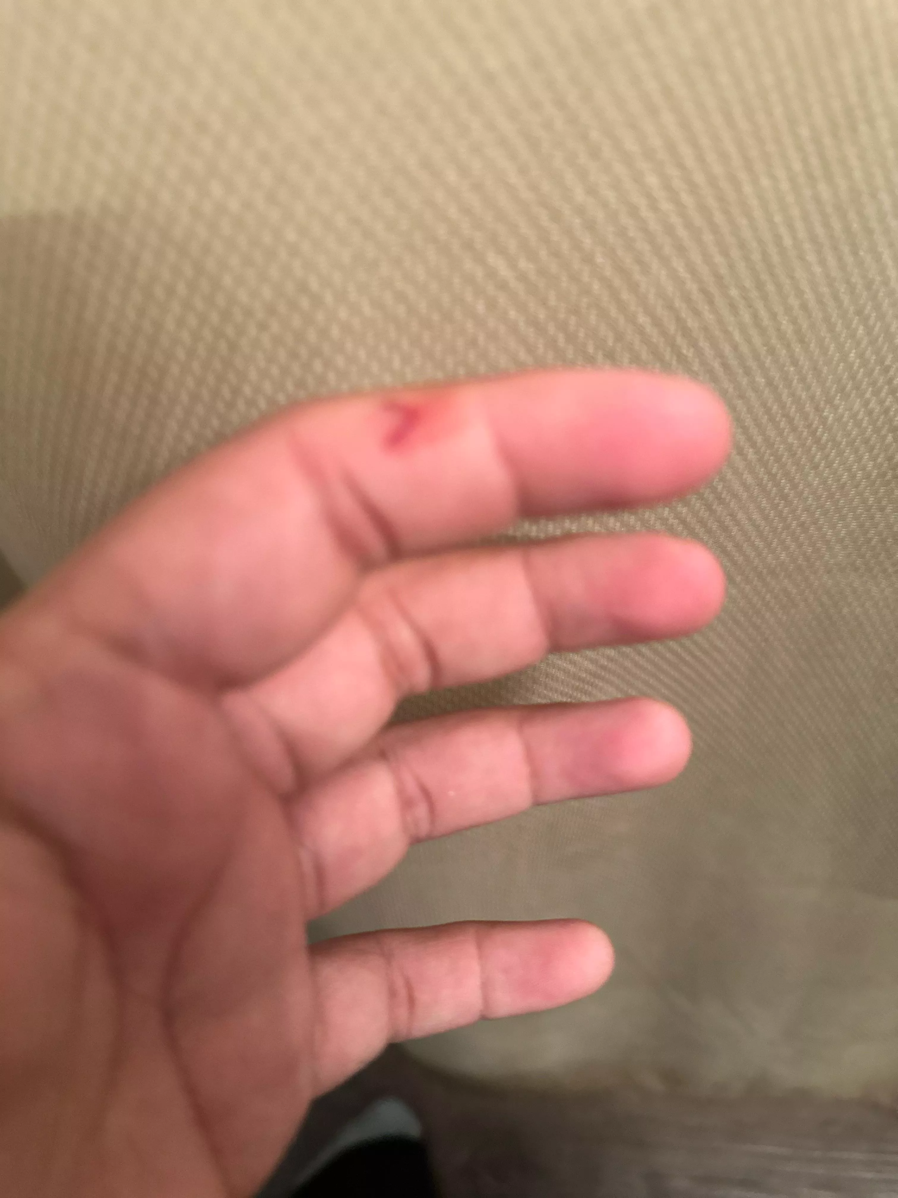 I cut into my finger yesterday and now my hand tingles and the cut keeps reopening. What do I do?