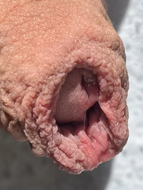 Mijn zachte voorhuid… voor de liefhebber