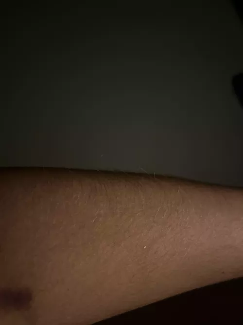 My hairy [arms] are getting longer 