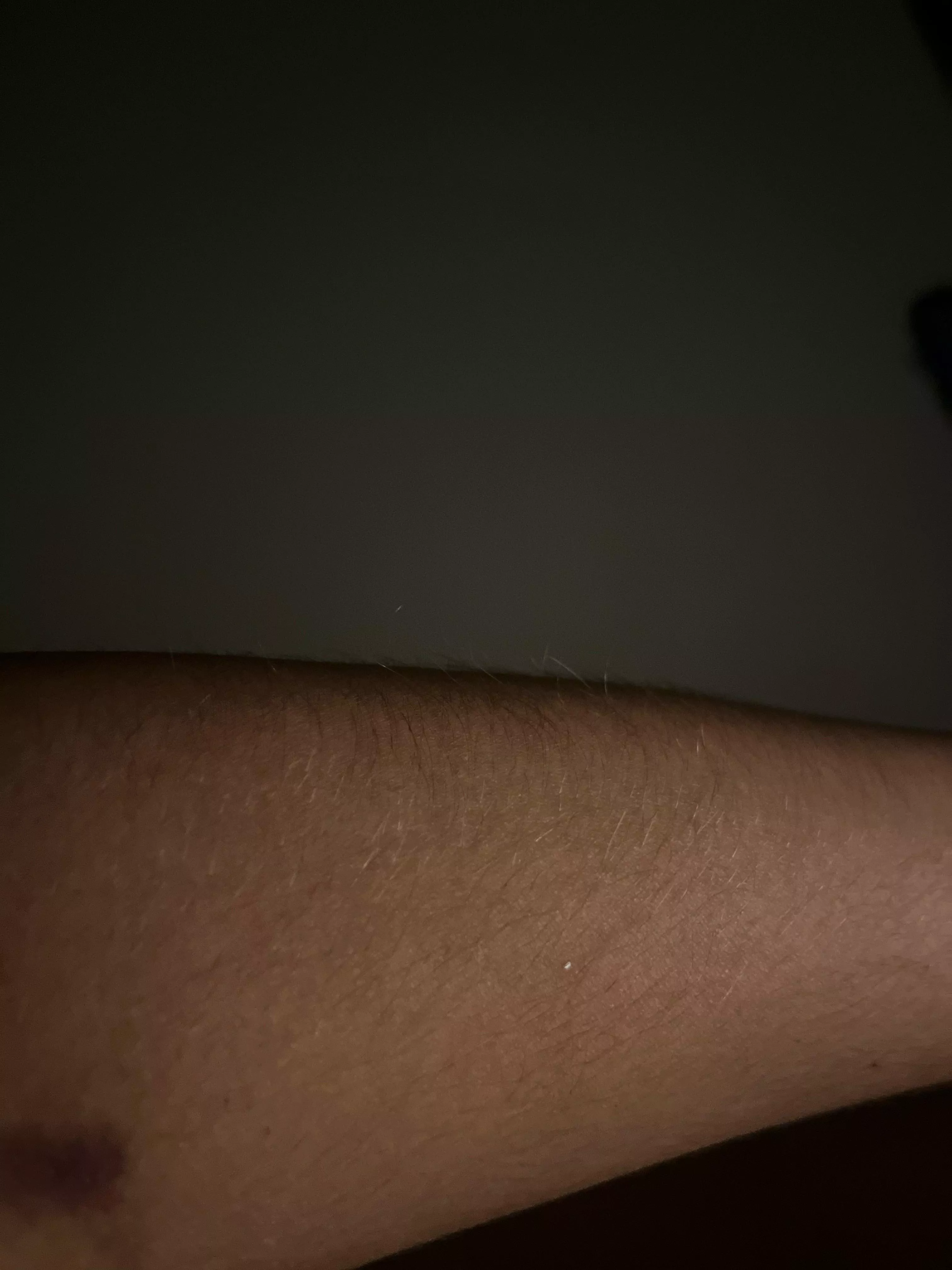 My hairy [arms] are getting longer 