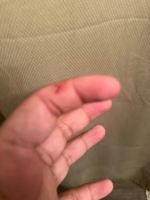 Quarter inch cut from a crafting scissors that happened yesterday. 