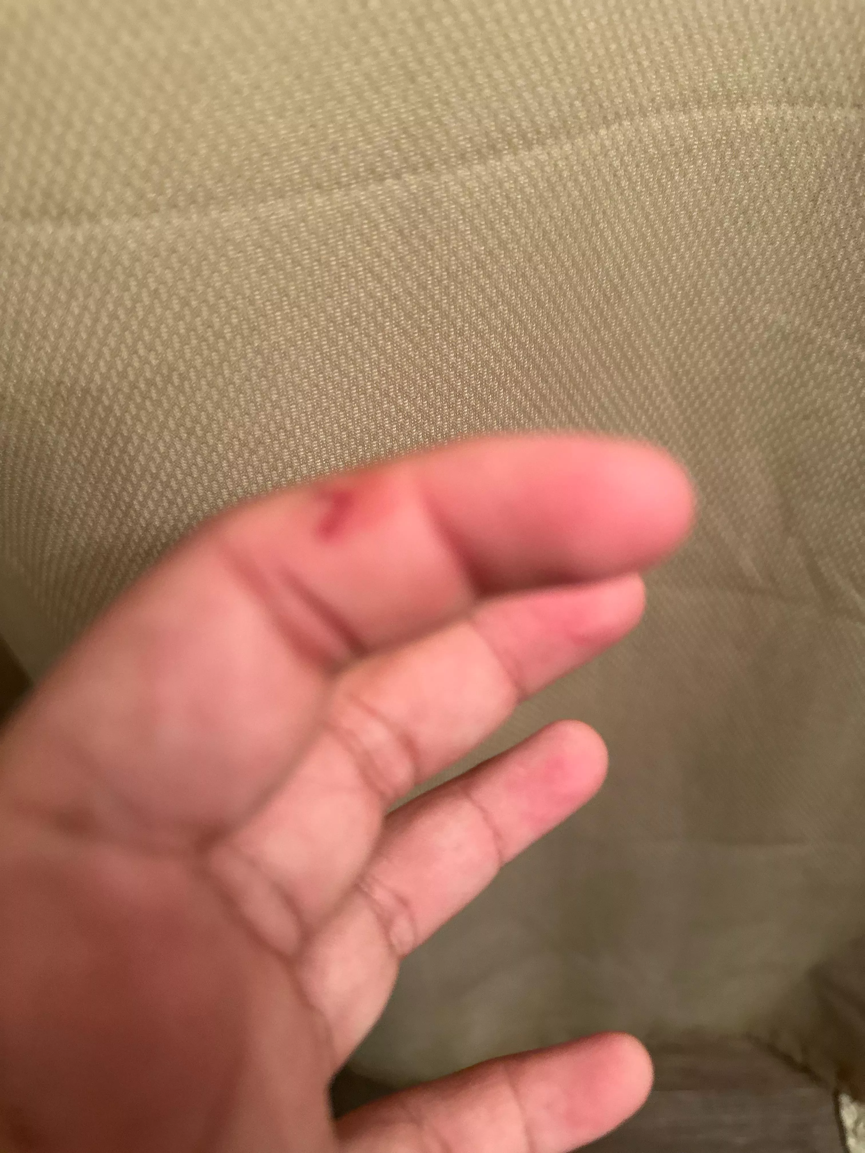 Quarter inch cut from a crafting scissors that happened yesterday. 