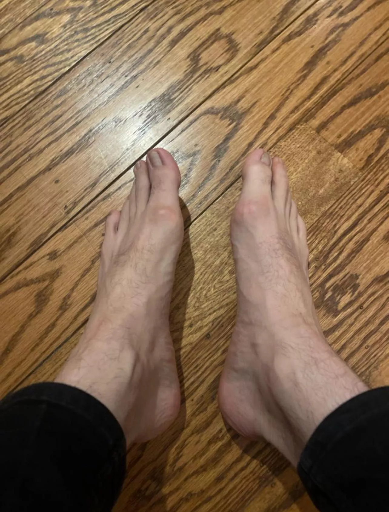 Size 15 and needing a rub down 