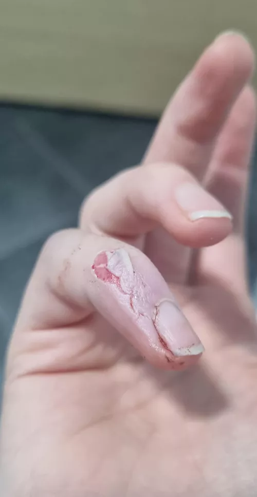 Tips on treating this? 