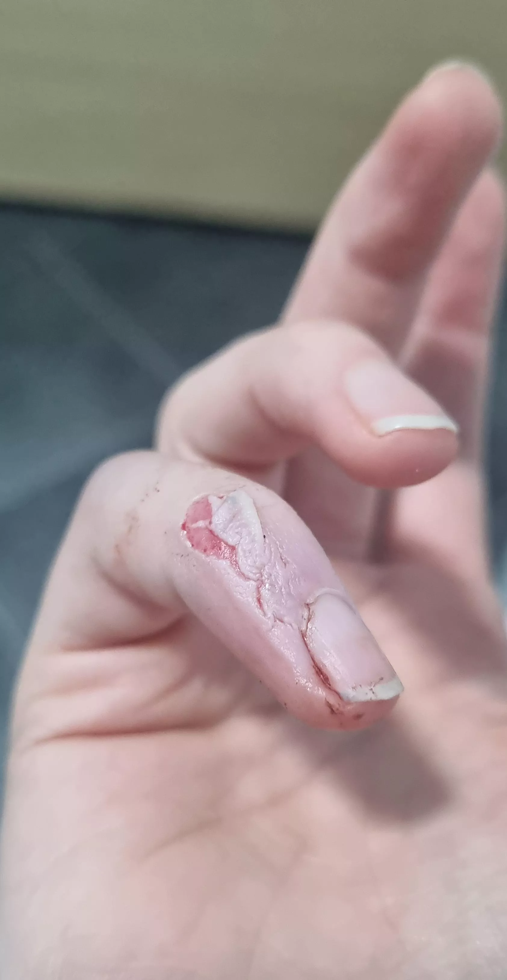 Tips on treating this? 