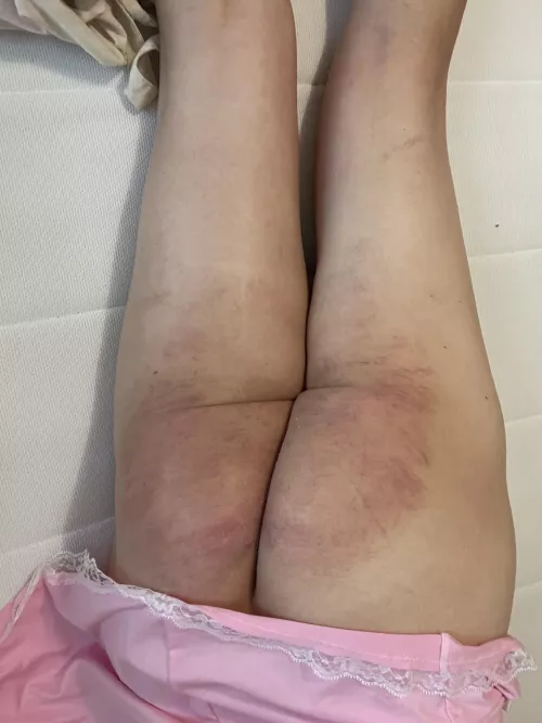 Some lovely colours starting to show after yesterday’s spanking