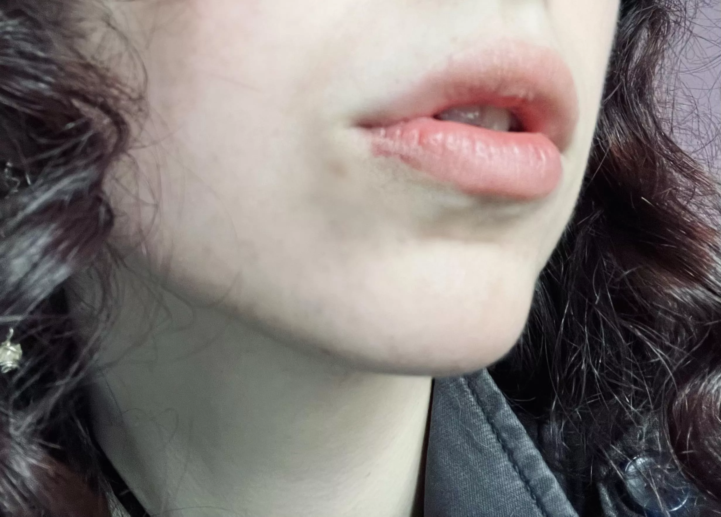 bruised lip from impact play :)
