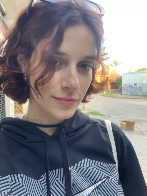 My freckles exploding on the way back from the party [IRTR]