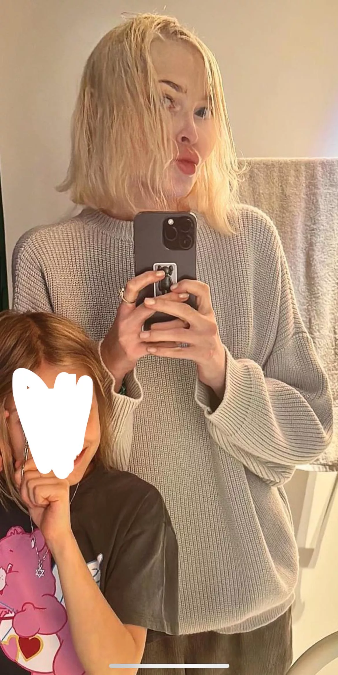 Oh no 😢 what’s she done to her face???? 