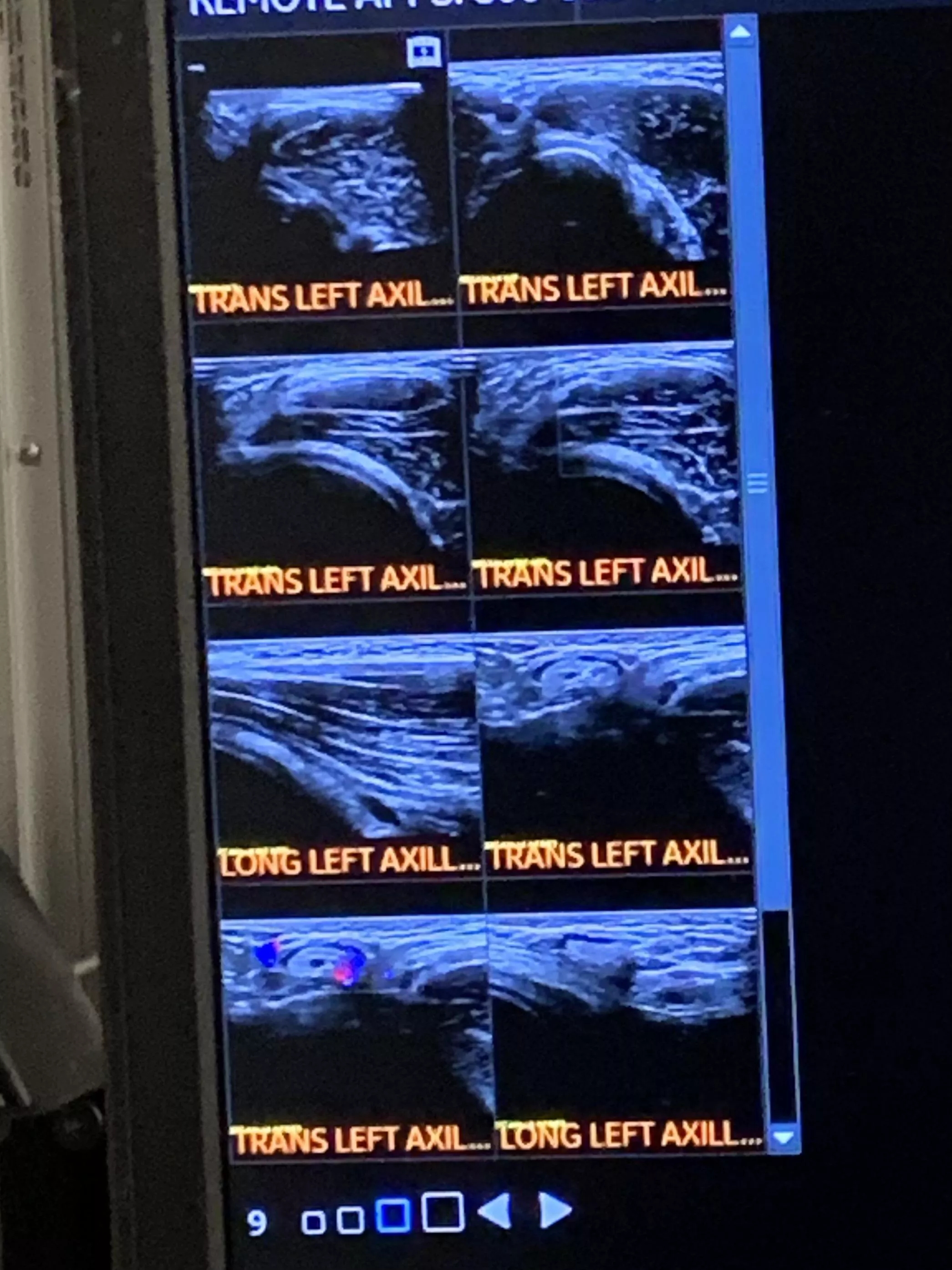 Any feedback on my axillary ultrasound?