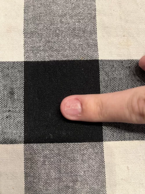 Anyone know what this is any doctors or like nail specialists?