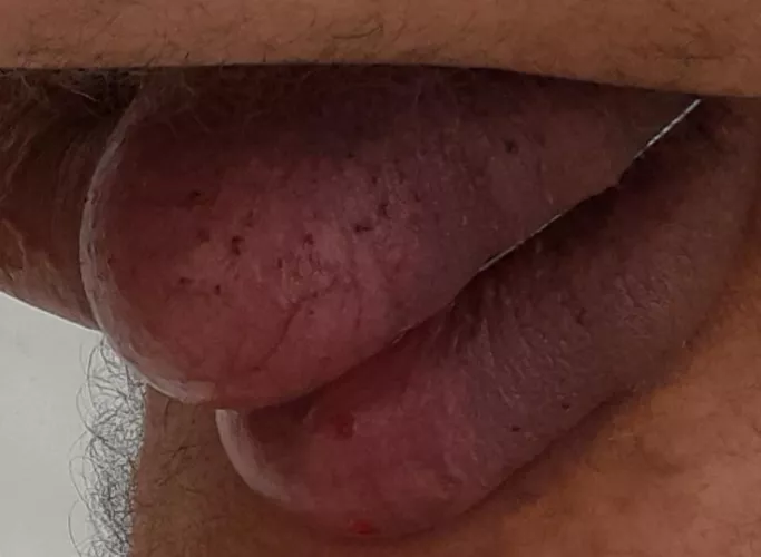 Aspetto della ipotetica  divisione 