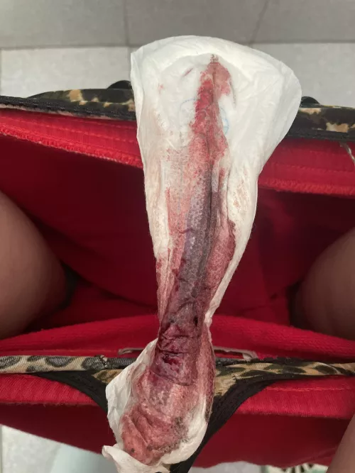 Can you guess what day of my period I'm going on? 